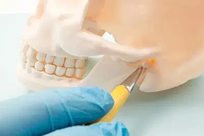 dentist showing where TMJ issues occur on a model of a skull