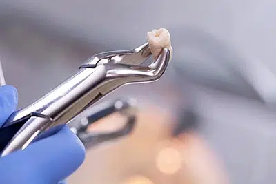 dentist holding a pulled tooth